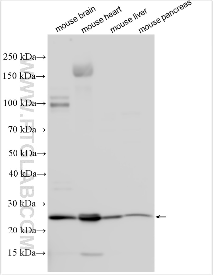 Western Blot (WB) analysis of various lysates using CIR Polyclonal antibody (32928-1-AP)