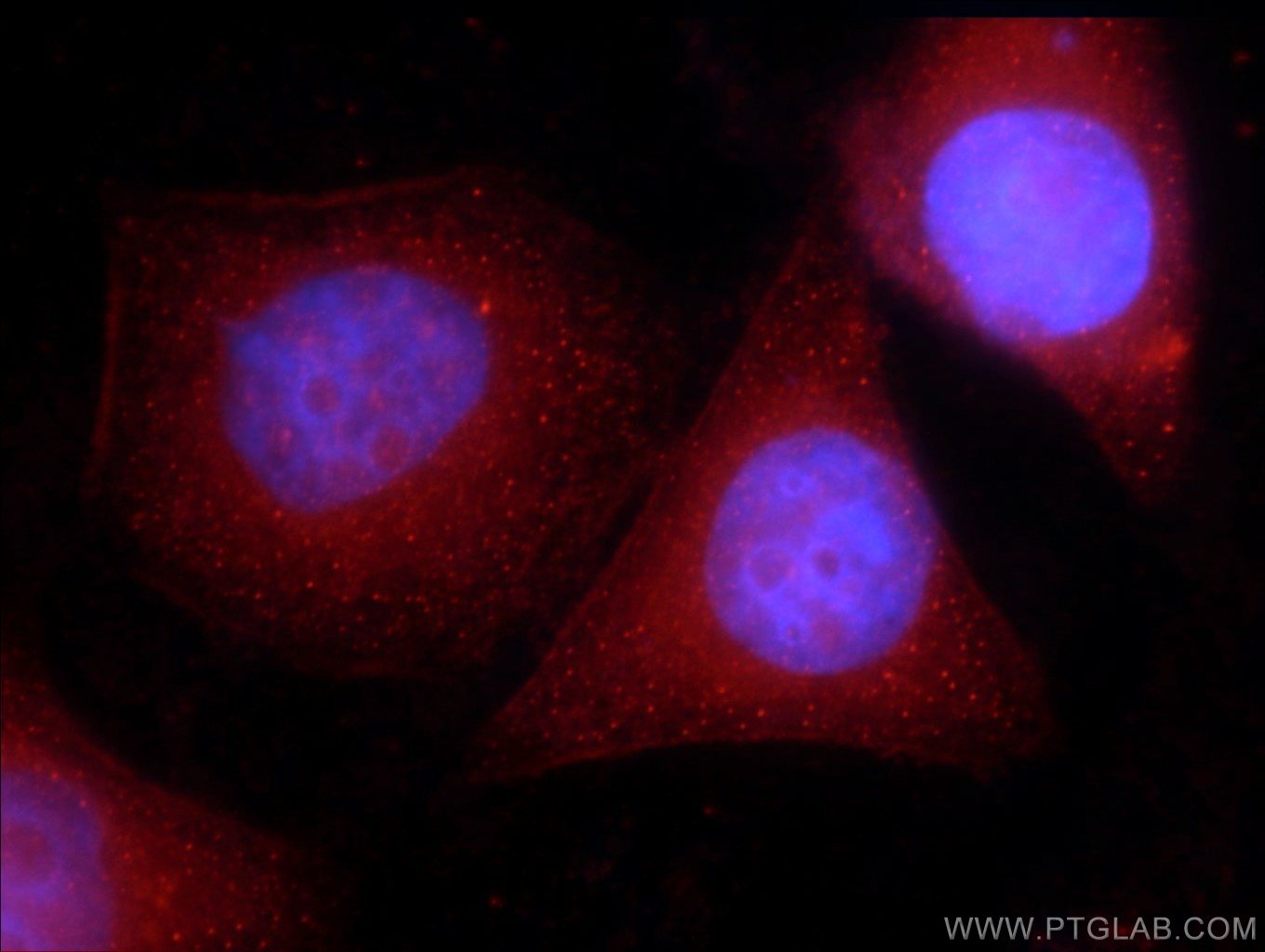 Immunofluorescence (IF) / fluorescent staining of HepG2 cells using CIRBP Polyclonal antibody (10209-2-AP)