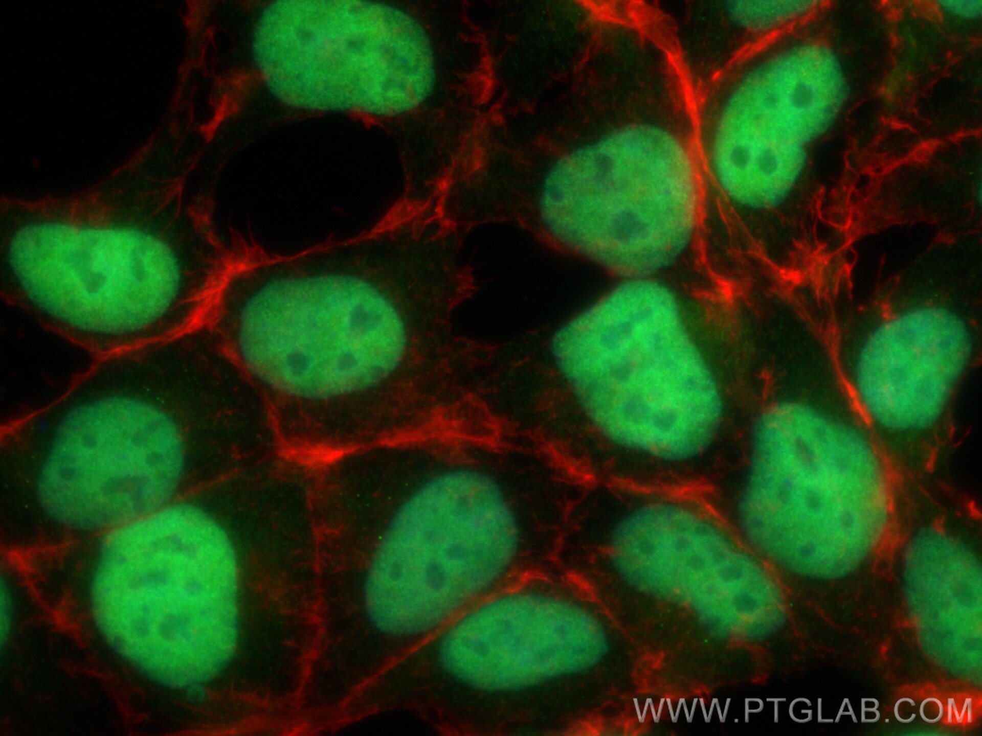 Immunofluorescence (IF) / fluorescent staining of HEK-293 cells using CIRBP Polyclonal antibody (10209-2-AP)