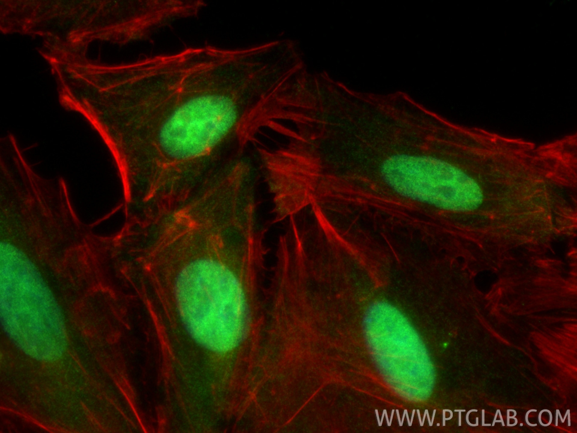 Immunofluorescence (IF) / fluorescent staining of A549 cells using CIRBP Polyclonal antibody (10209-2-AP)