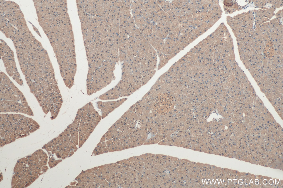 Immunohistochemistry (IHC) staining of mouse pancreas tissue using CIRBP Polyclonal antibody (10209-2-AP)