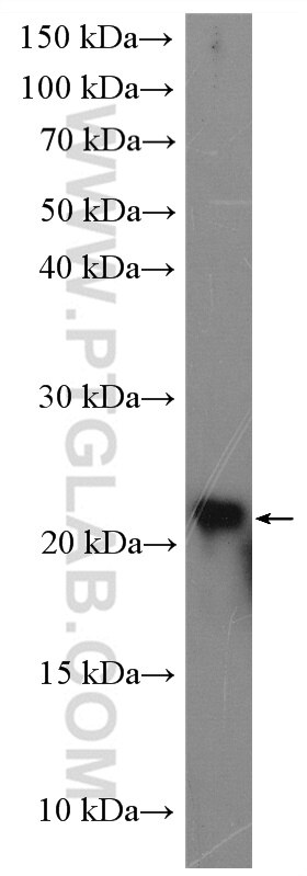 Western Blot (WB) analysis of mouse brain tissue using CIRBP Polyclonal antibody (10209-2-AP)