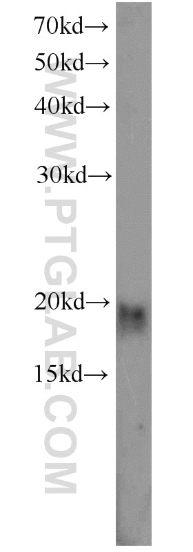 Western Blot (WB) analysis of Y79 cells using CIRBP Polyclonal antibody (10209-2-AP)