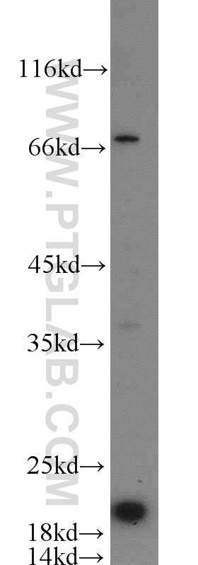 CIRBP Polyclonal antibody