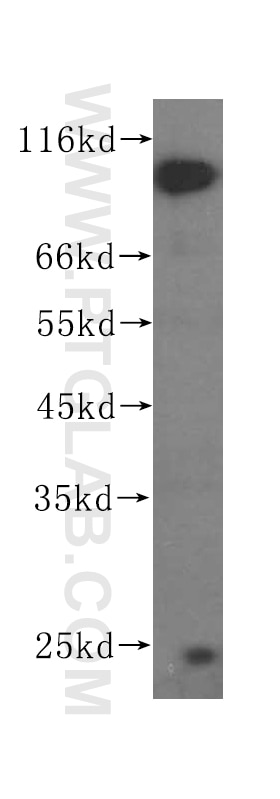 Western Blot (WB) analysis of HEK-293 cells using CIRBP Monoclonal antibody (60025-1-Ig)