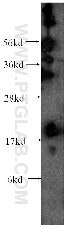 Western Blot (WB) analysis of HEK-293 cells using CIRBP Monoclonal antibody (60025-2-Ig)