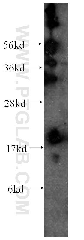 WB analysis of HEK-293 using 60025-2-Ig