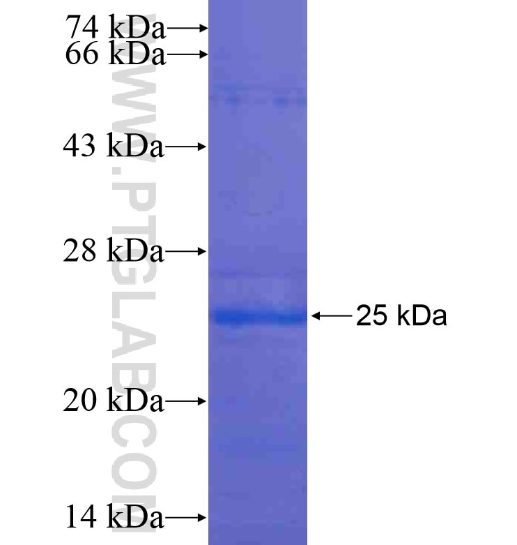CIRBP fusion protein Ag16702 SDS-PAGE