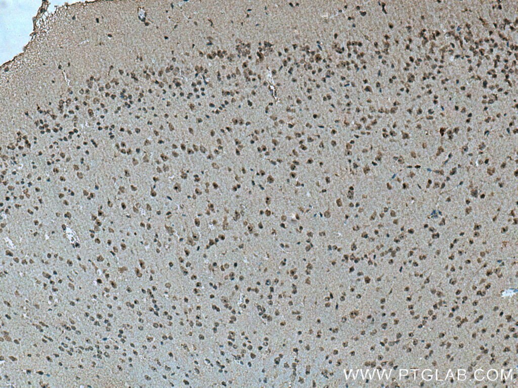 Immunohistochemistry (IHC) staining of mouse brain tissue using Cirhin Polyclonal antibody (11057-1-AP)