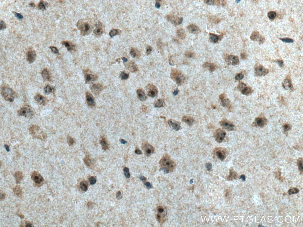 Immunohistochemistry (IHC) staining of mouse brain tissue using Cirhin Polyclonal antibody (11057-1-AP)