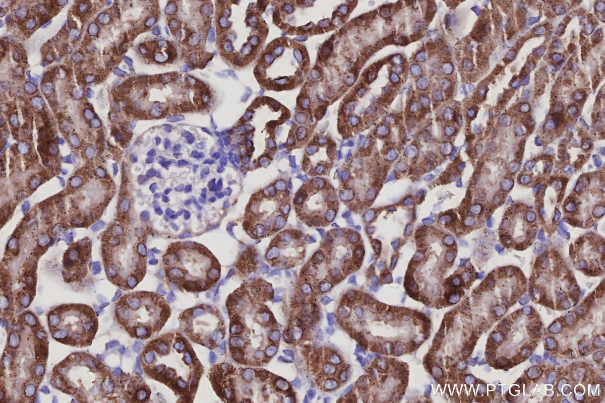 Immunohistochemistry (IHC) staining of mouse kidney tissue using CISD1 Monoclonal antibody (68030-1-Ig)