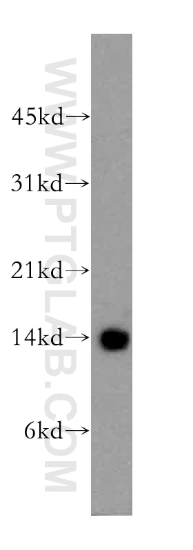 WB analysis of human brain using 13318-1-AP