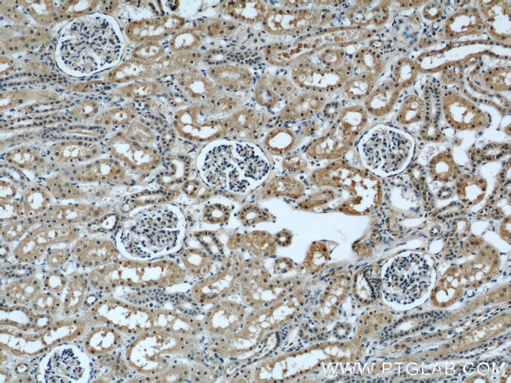 IHC staining of human kidney using 66082-1-Ig