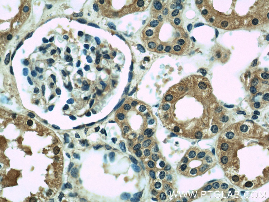 Immunohistochemistry (IHC) staining of human kidney tissue using CISD2-Specific Monoclonal antibody (66082-1-Ig)