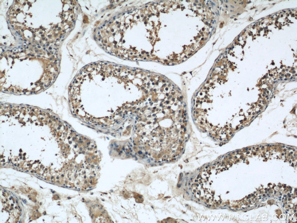 Immunohistochemistry (IHC) staining of human testis tissue using CISD2-Specific Monoclonal antibody (66082-1-Ig)