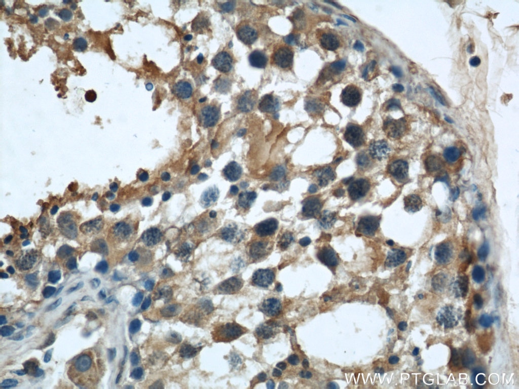 Immunohistochemistry (IHC) staining of human testis tissue using CISD2-Specific Monoclonal antibody (66082-1-Ig)