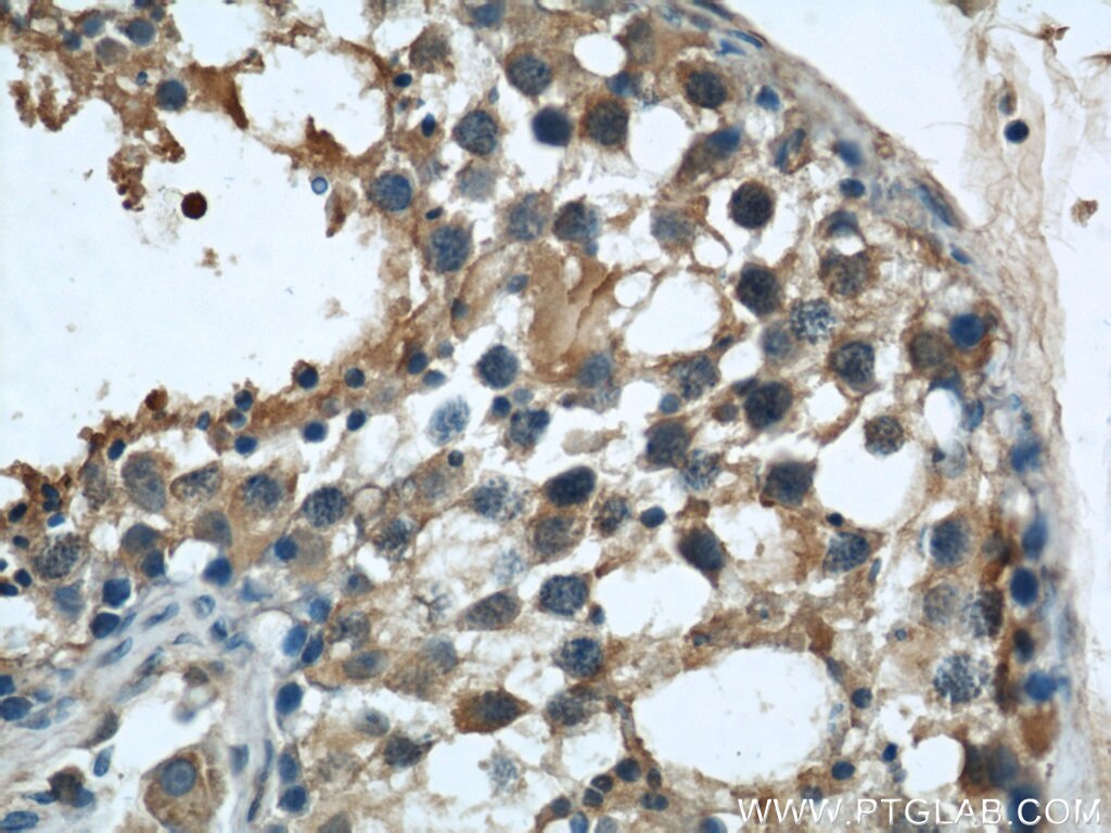 IHC staining of human testis using 66082-1-Ig