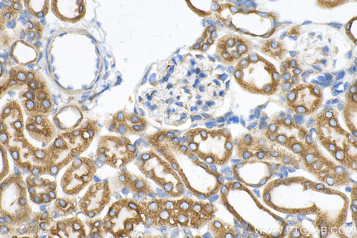 Immunohistochemistry (IHC) staining of mouse kidney tissue using CISD2 Recombinant antibody (82802-10-RR)