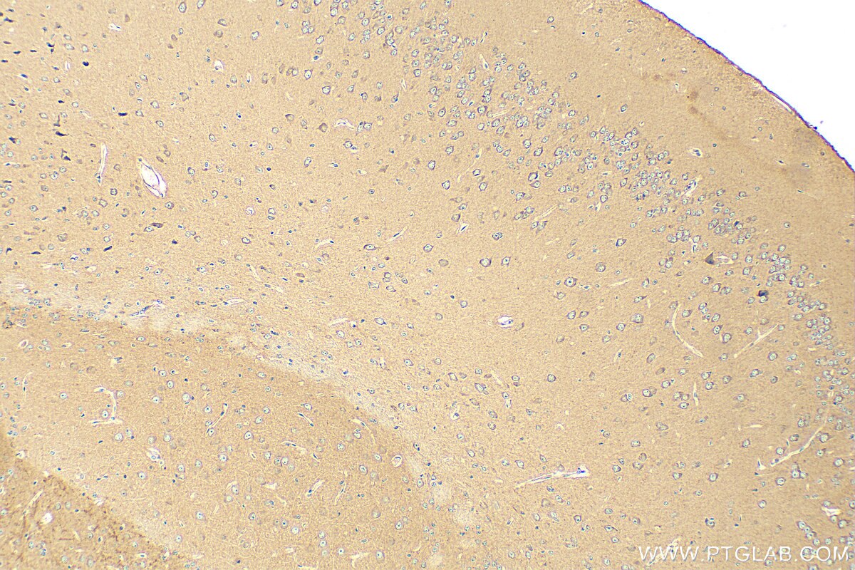 Immunohistochemistry (IHC) staining of mouse brain tissue using CIT Polyclonal antibody (20033-1-AP)