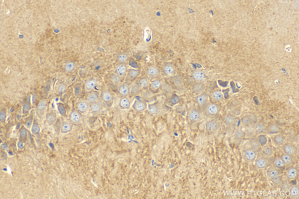 Immunohistochemistry (IHC) staining of mouse brain tissue using CIT Polyclonal antibody (20033-1-AP)