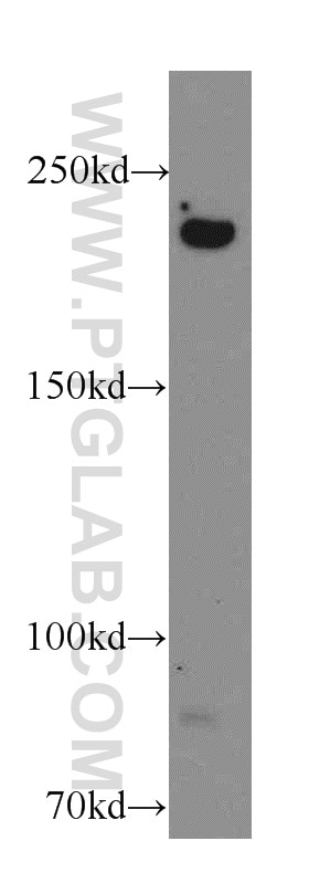 Western Blot (WB) analysis of A431 cells using CIT Polyclonal antibody (20033-1-AP)