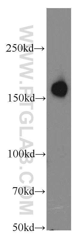 Western Blot (WB) analysis of mouse brain tissue using CIT Polyclonal antibody (20033-1-AP)