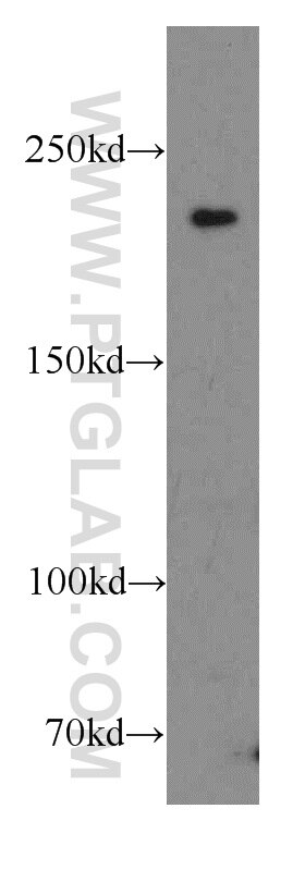 Western Blot (WB) analysis of HeLa cells using CIT Polyclonal antibody (20033-1-AP)