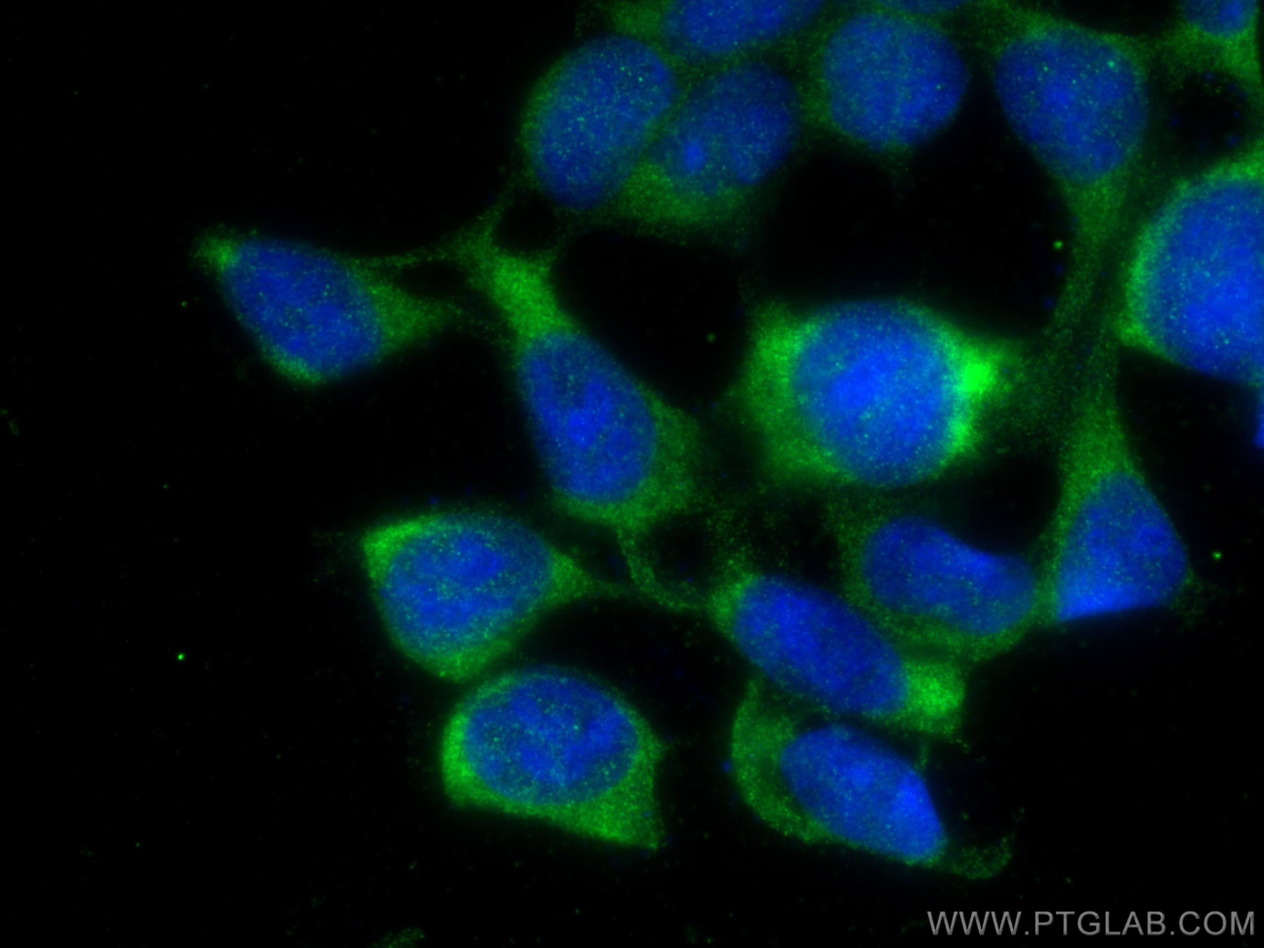 Immunofluorescence (IF) / fluorescent staining of HEK-293 cells using CITED1 Polyclonal antibody (26999-1-AP)
