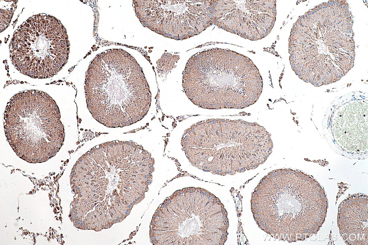 IHC staining of rat testis using 26999-1-AP