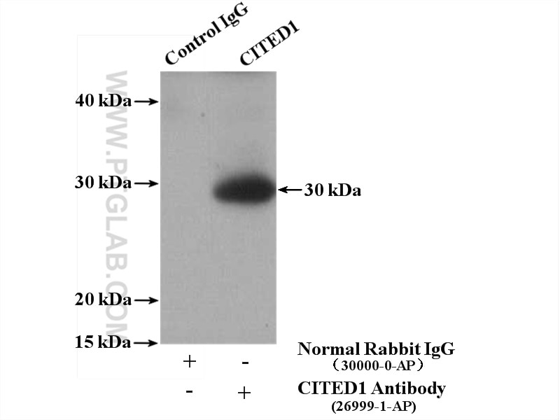 Immunoprecipitation (IP) experiment of A375 cells using CITED1 Polyclonal antibody (26999-1-AP)