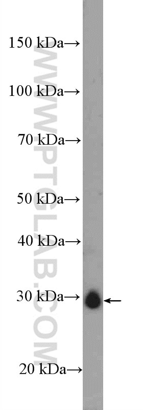 Western Blot (WB) analysis of rat testis tissue using CITED1 Polyclonal antibody (26999-1-AP)