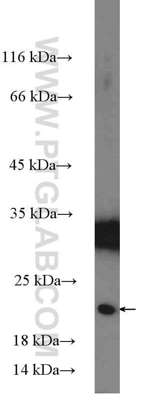 Western Blot (WB) analysis of mouse testis tissue using CITED1 Polyclonal antibody (26999-1-AP)