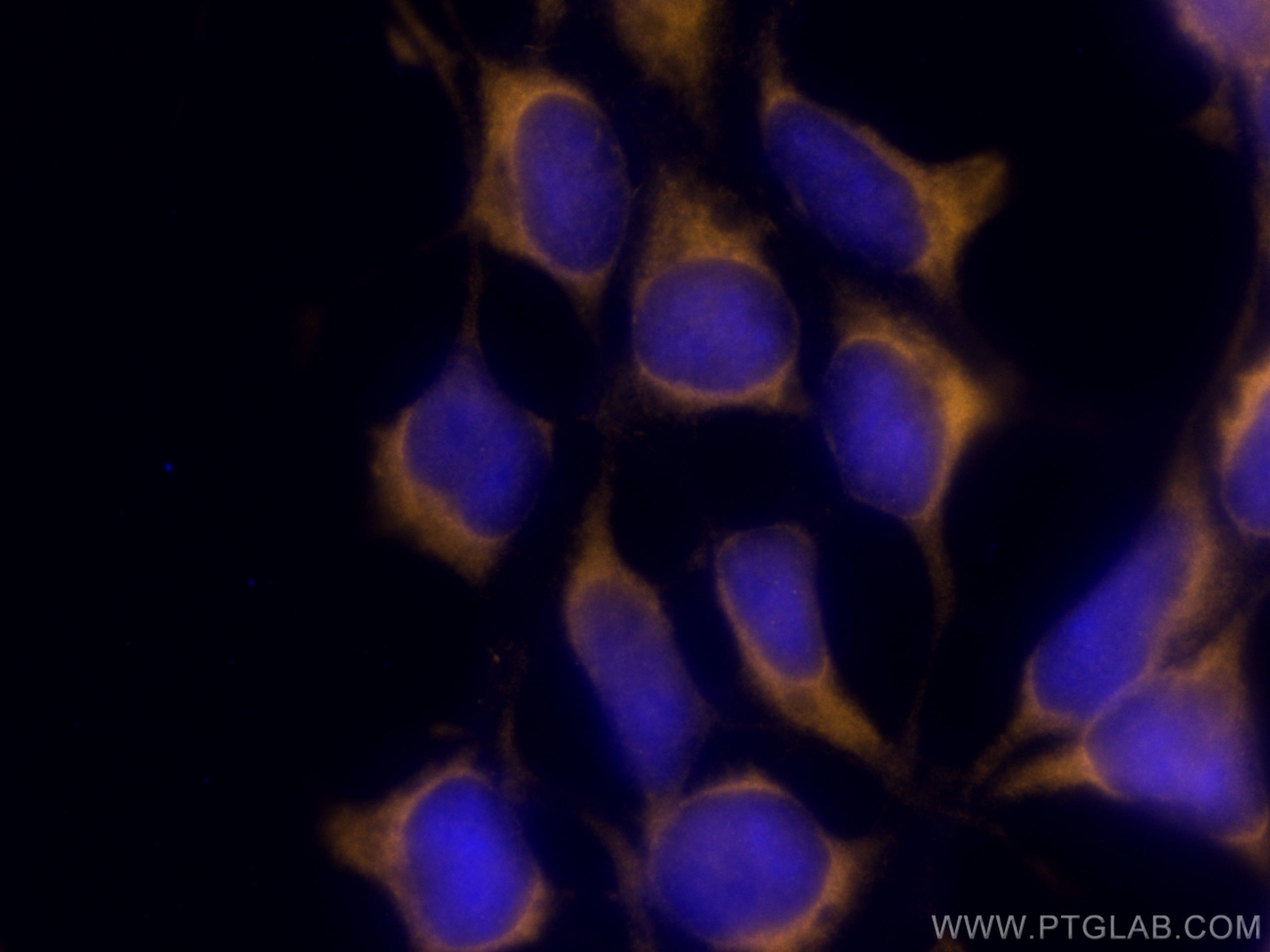 Immunofluorescence (IF) / fluorescent staining of HEK-293 cells using CoraLite®555-conjugated CITED1 Polyclonal antibody (CL555-26999)