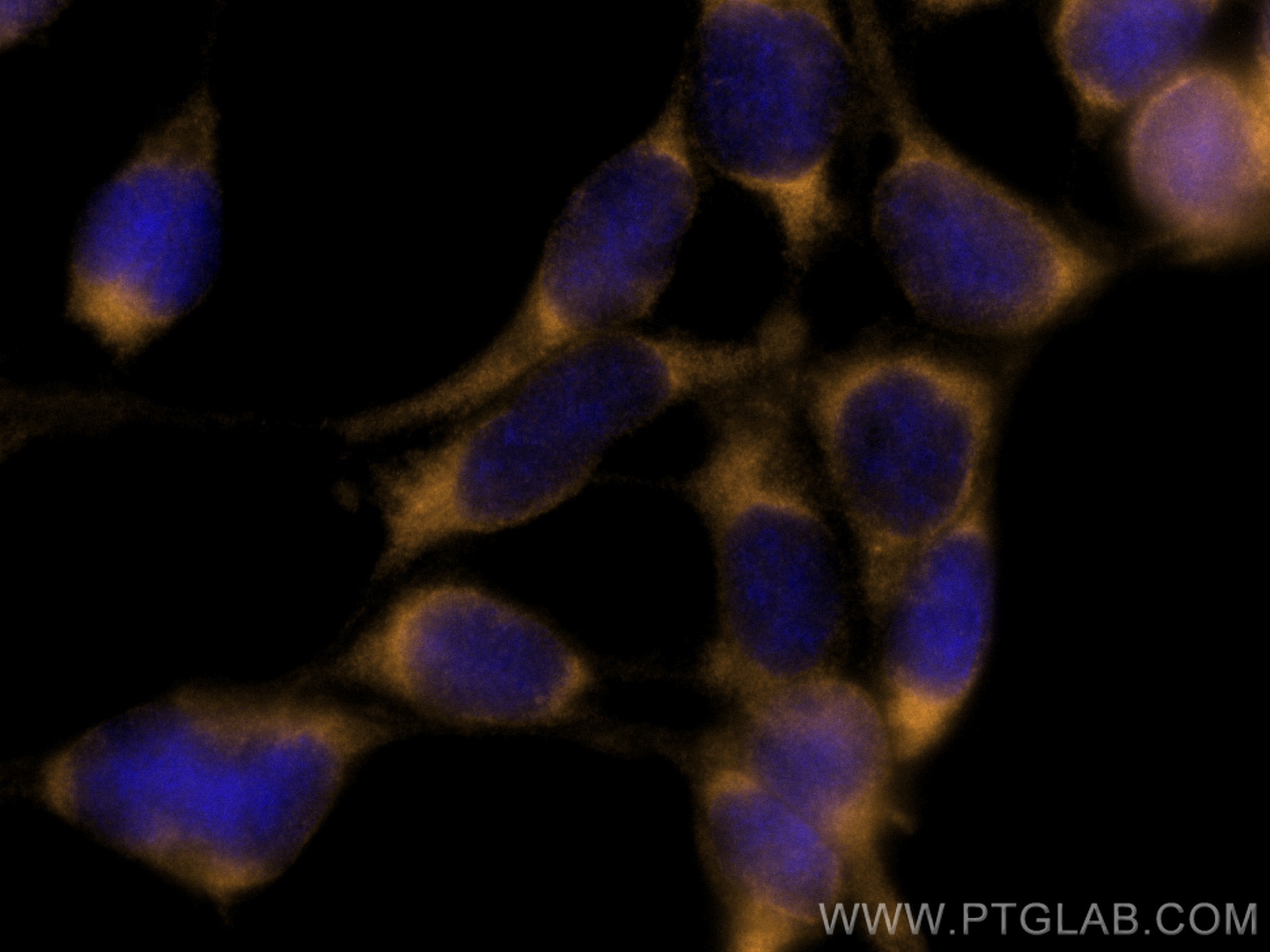 Immunofluorescence (IF) / fluorescent staining of HEK-293 cells using CoraLite®555-conjugated CITED1 Polyclonal antibody (CL555-26999)