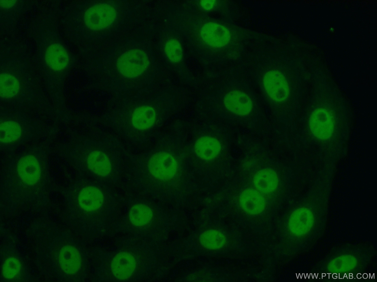 IF Staining of SH-SY5Y using 15021-1-AP