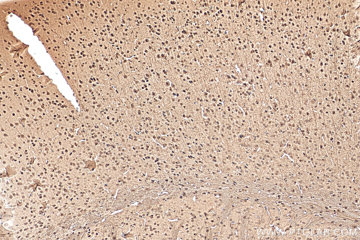 Immunohistochemistry (IHC) staining of mouse brain tissue using CITED2 Polyclonal antibody (15021-1-AP)