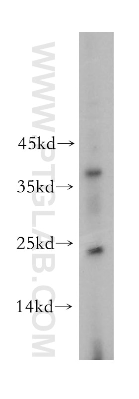 Western Blot (WB) analysis of SH-SY5Y cells using CITED2 Polyclonal antibody (15021-1-AP)