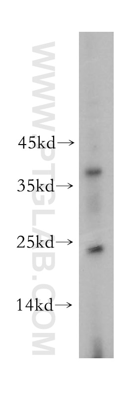 WB analysis of SH-SY5Y using 15021-1-AP