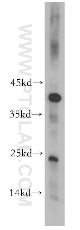 Western Blot (WB) analysis of mouse brain tissue using CITED2 Polyclonal antibody (15021-1-AP)