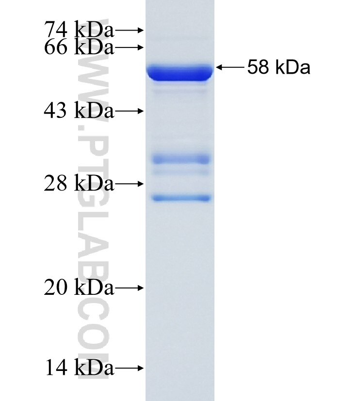 CIZ1 fusion protein Ag35418 SDS-PAGE