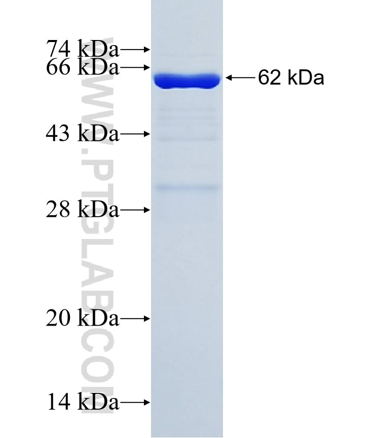 CK19 fusion protein Ag1085 SDS-PAGE