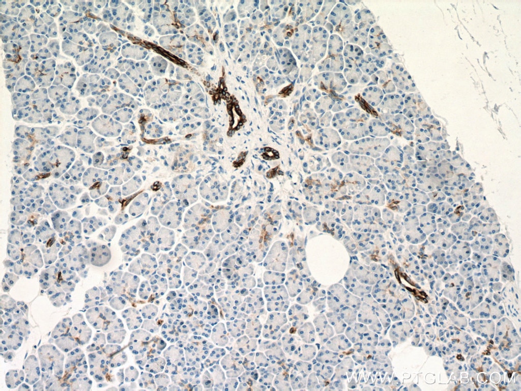 Immunohistochemistry (IHC) staining of human pancreas tissue using Cytokeratin 7 Monoclonal antibody (66483-1-Ig)