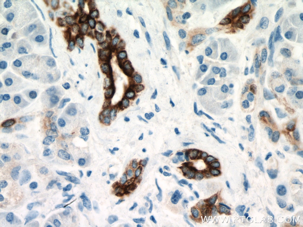 Immunohistochemistry (IHC) staining of human pancreas tissue using Cytokeratin 7 Monoclonal antibody (66483-1-Ig)