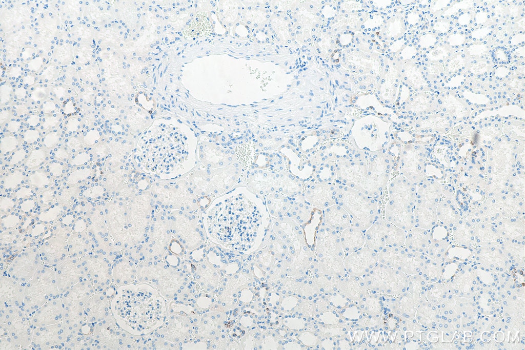 Immunohistochemistry (IHC) staining of human kidney tissue using Cytokeratin 7 Monoclonal antibody (66483-1-Ig)