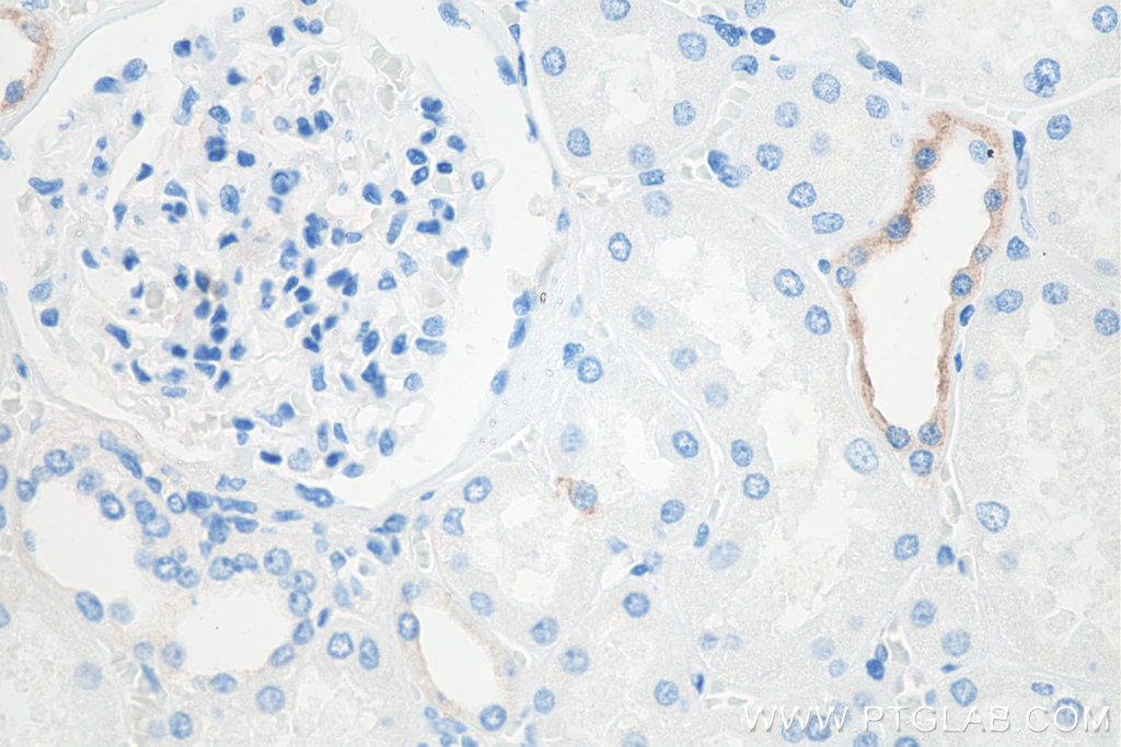 Immunohistochemistry (IHC) staining of human kidney tissue using Cytokeratin 7 Monoclonal antibody (66483-1-Ig)