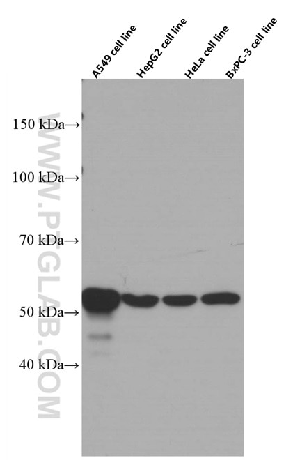 Western Blot (WB) analysis of various lysates using Cytokeratin 7 Monoclonal antibody (66483-1-Ig)
