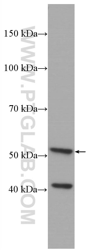 Western Blot (WB) analysis of A431 cells using Cytokeratin 7 Monoclonal antibody (66483-1-Ig)