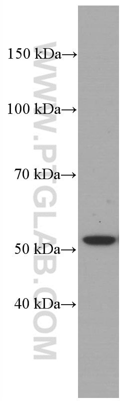 Western Blot (WB) analysis of T-47D cells using Cytokeratin 7 Monoclonal antibody (66483-1-Ig)
