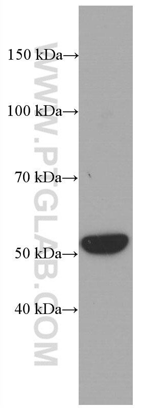 Western Blot (WB) analysis of PC-3 cells using Cytokeratin 7 Monoclonal antibody (66483-1-Ig)