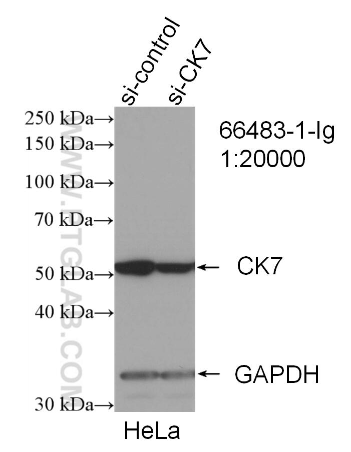 Western Blot (WB) analysis of HeLa cells using Cytokeratin 7 Monoclonal antibody (66483-1-Ig)